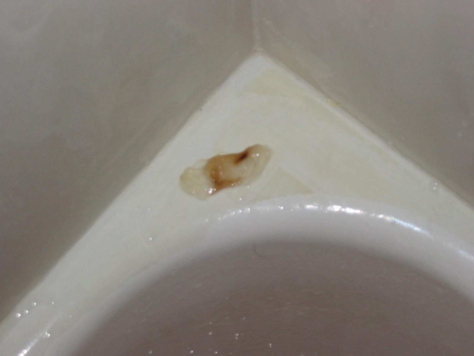 Mucus Plug Pregnancy